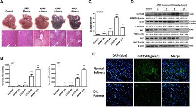 GLT25D2 Is Critical for Inflammatory Immune Response to Promote Acetaminophen-Induced Hepatotoxicity by Autophagy Pathway